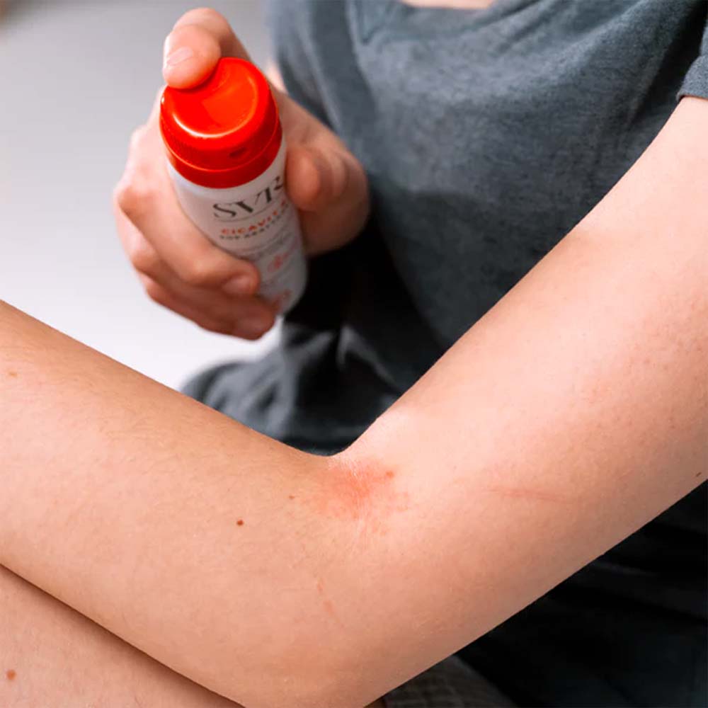 SVR Cicavit+ - SOS Grattage - spray calmant anti-prurit și anti-urme, 40ml