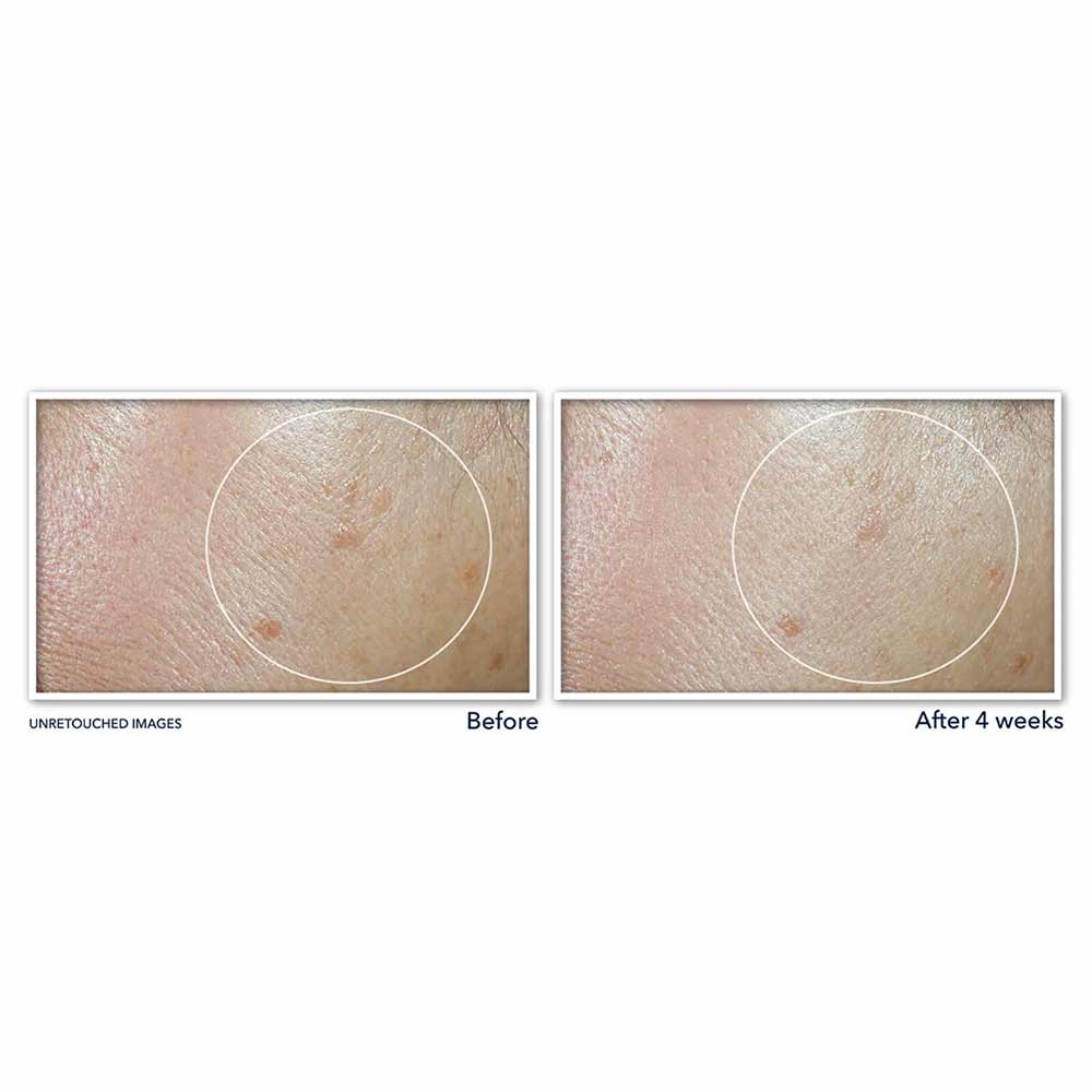 ROC Multi Correxion - Even Tone + Lift Cremă hidratantă pentru față cu SPF30, 50ml