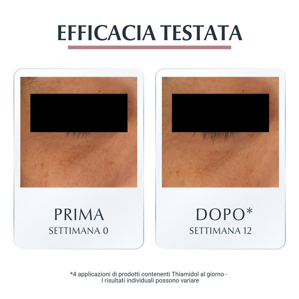 EUCERIN Anti-Pigment - Cremă iluminatoare pentru conturul ochilor și cearcăne 15 ml