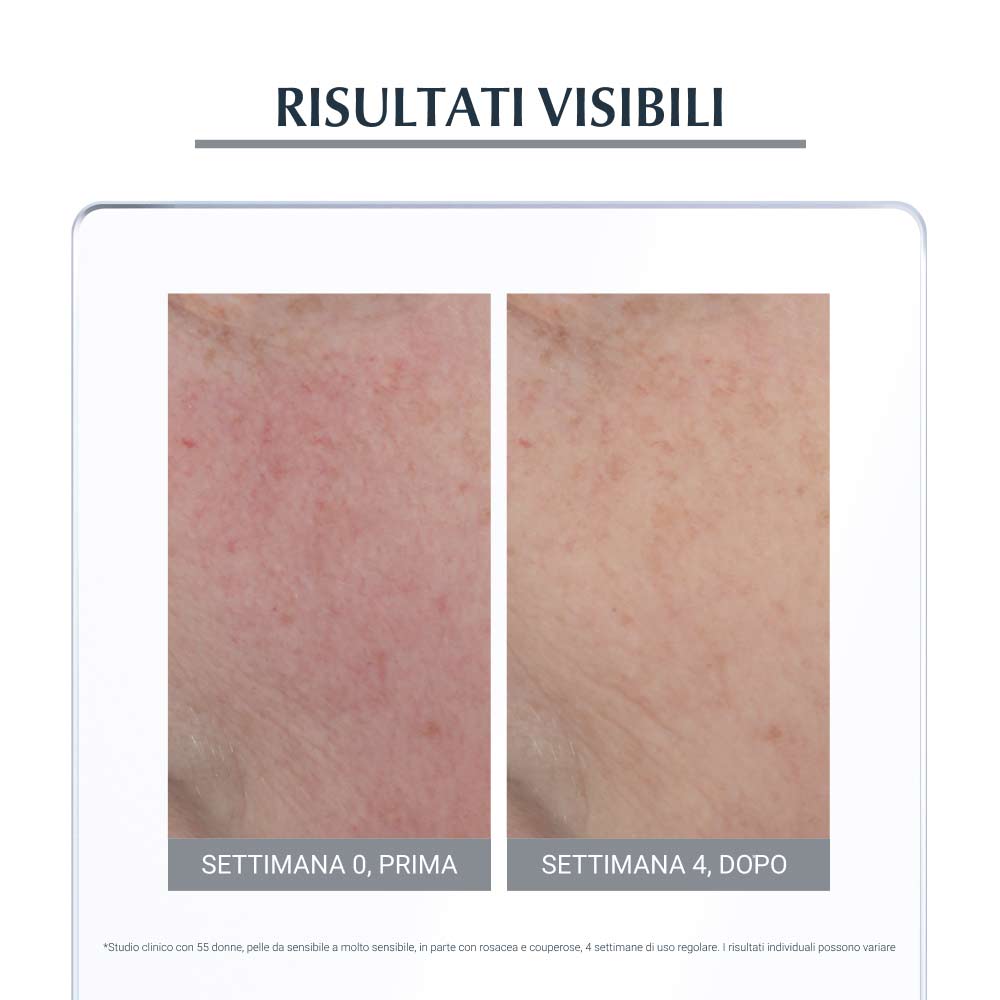 EUCERIN Anti-Rose - Tratament calmant de noapte 50 ml