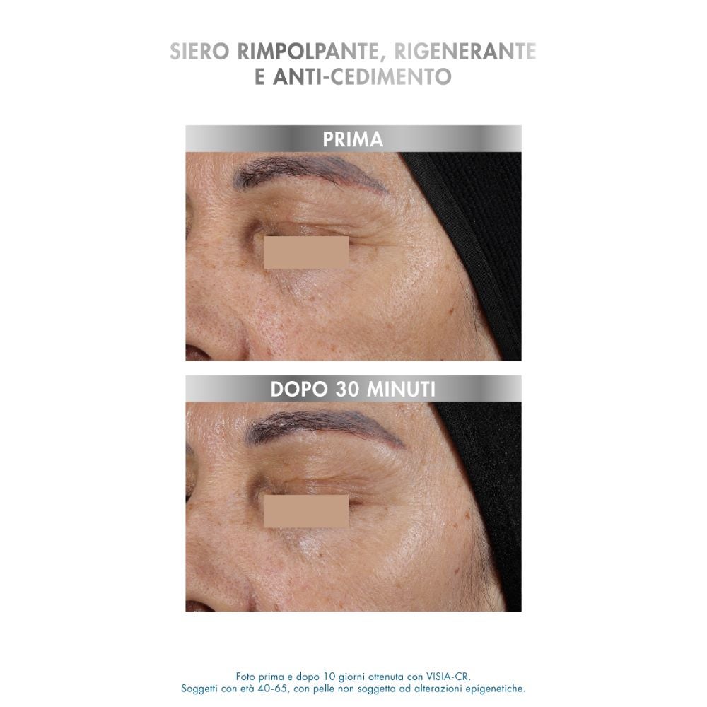 MIAMO A ge Reverse - Epi gena ge Shot ser re generant, cu efect de volum și anti-lăsare, 10 serin gi da 1 ml